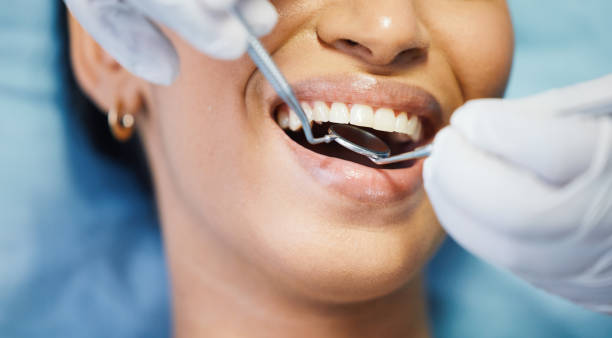 Best Emergency Dentist for Knocked-Out Tooth in Creswell, OR